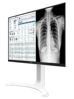 27 (68.58cm) UHD 8MP Clinical Review Monitor