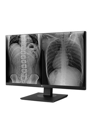 8MP Clinical Review Monitor
