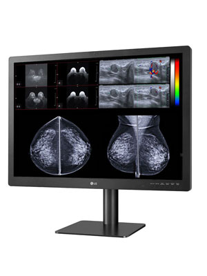 31 (78.74cm) 12MP Diagnostic Monitor for Mammography
